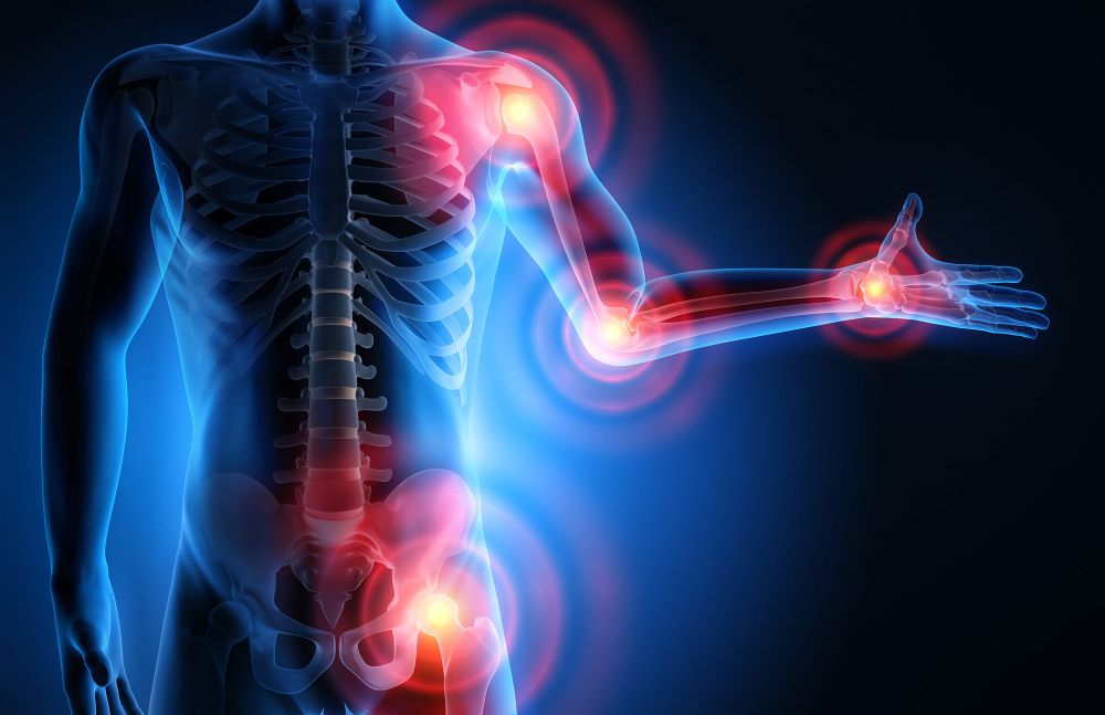Mit der richtigen Mischung aus Bewegung, Medikamenten und Naturmedizin!